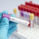 Maranhão registra mais de 27 mil pessoas vivendo com HIV e intensifica ações de prevenção