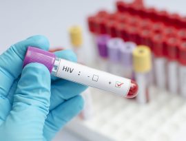 Exame-HIV-Hilab